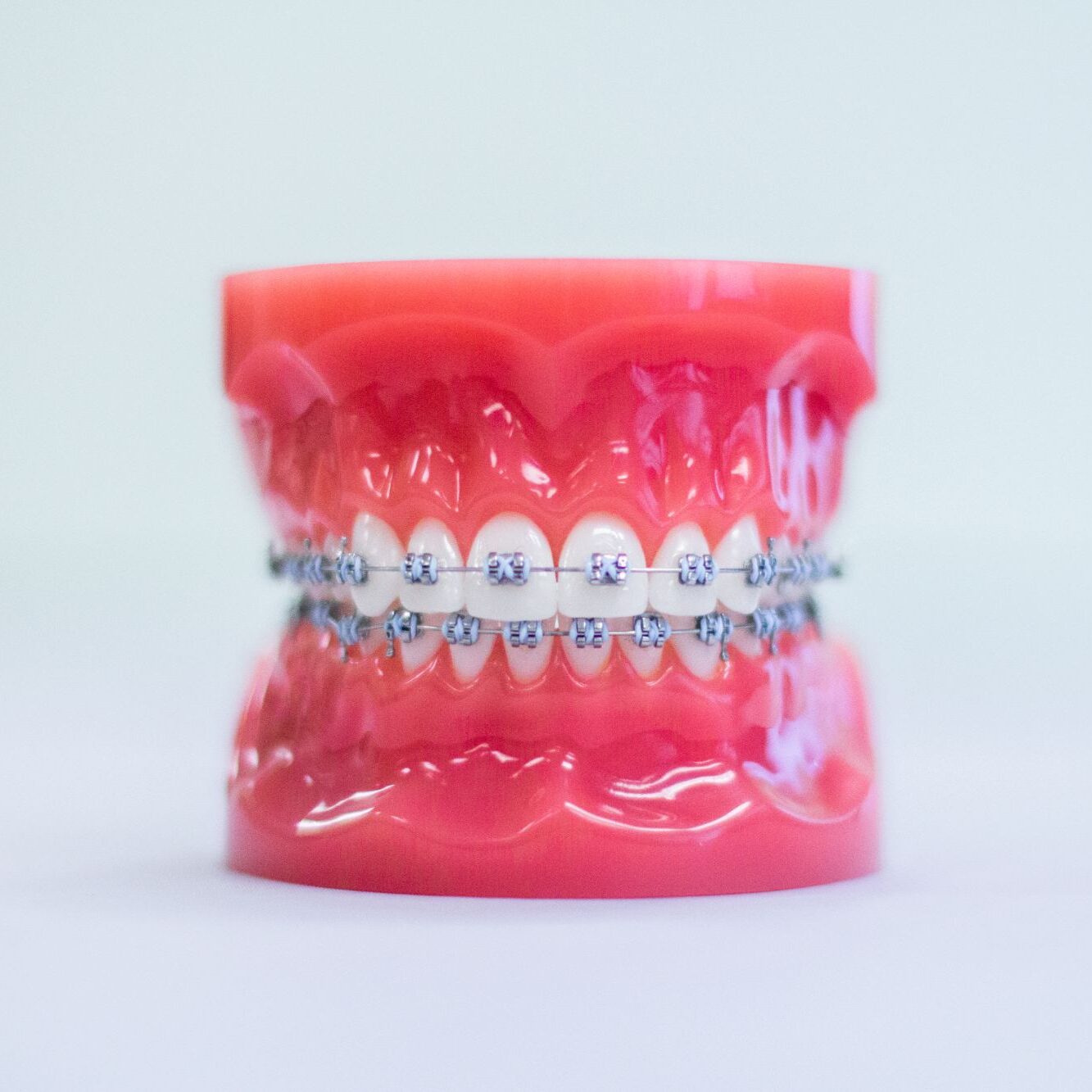 Braces & Invisalign Halifax NS