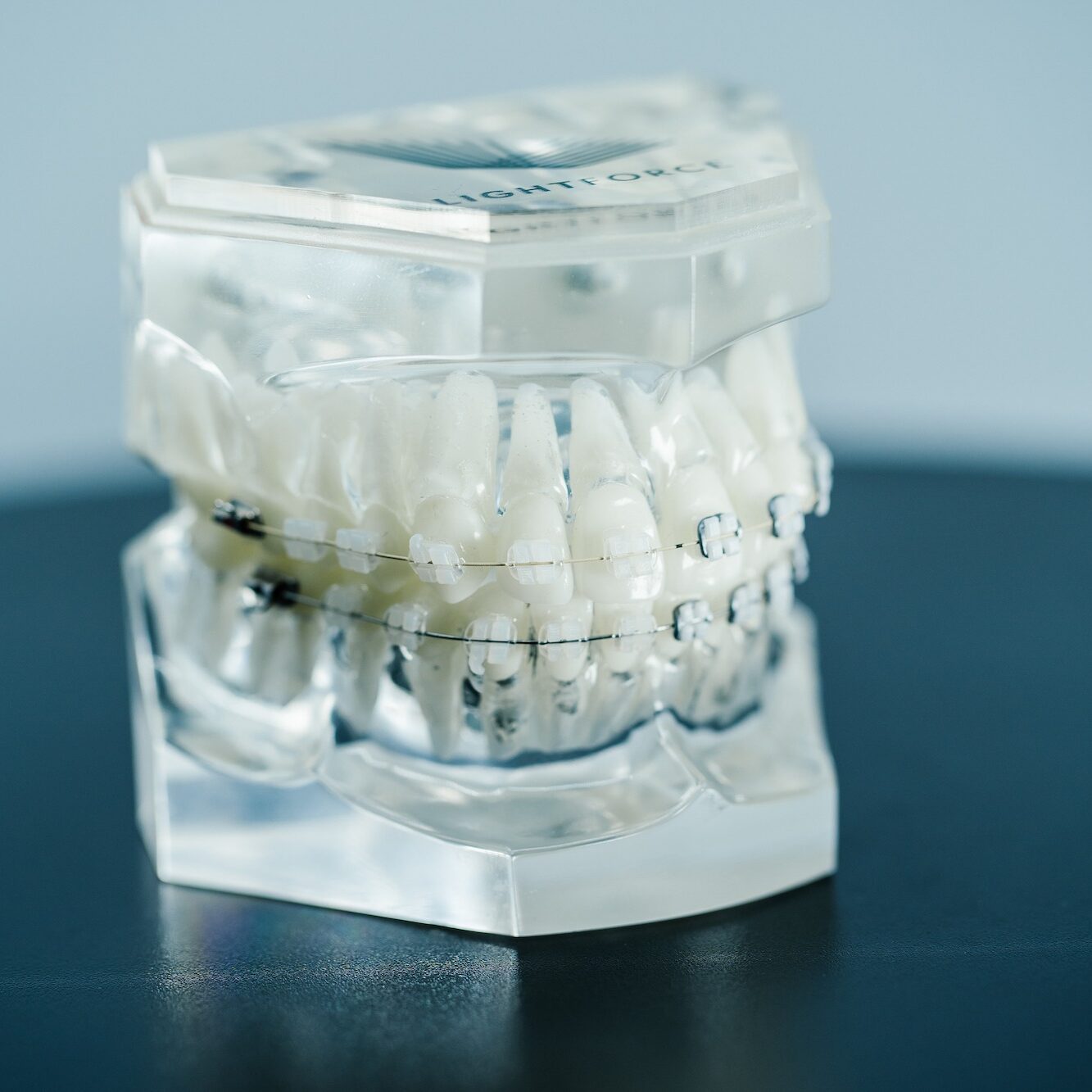 Clear braces